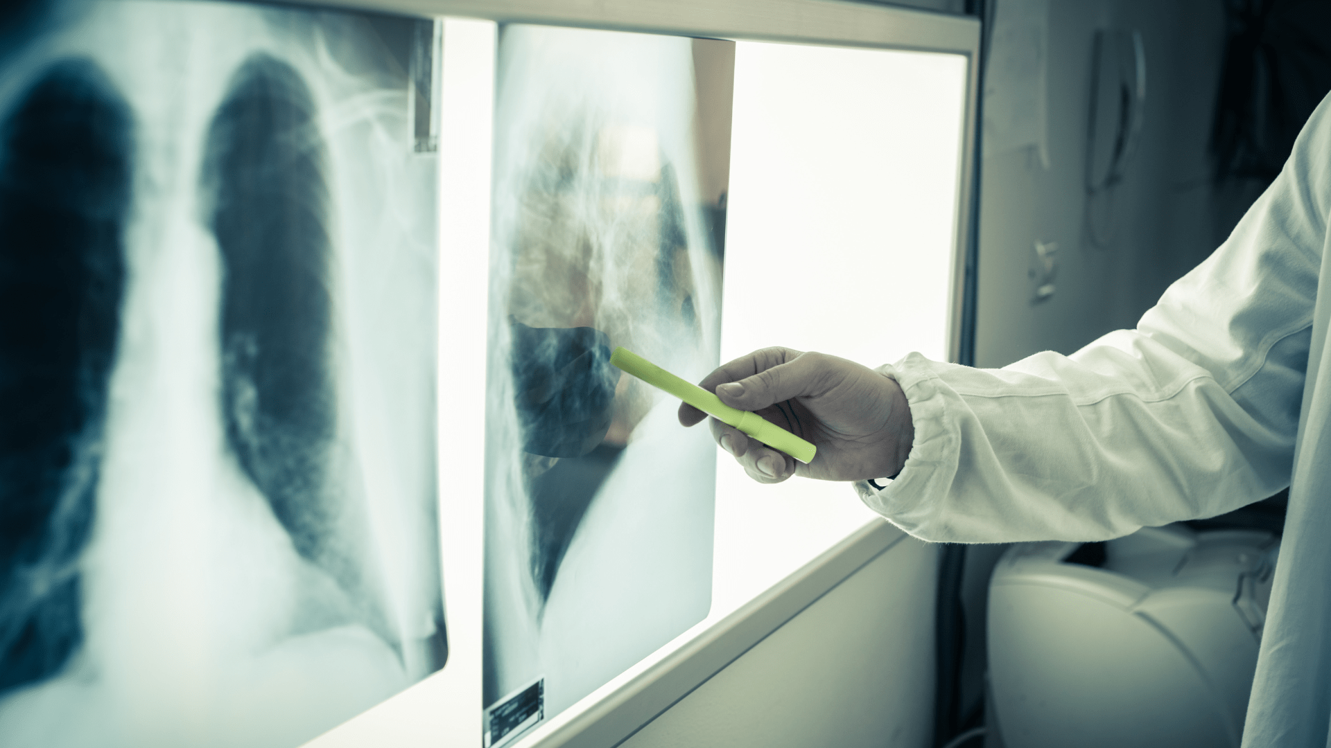 The artificial intelligence frontier hits health care - CommonWealth Beacon